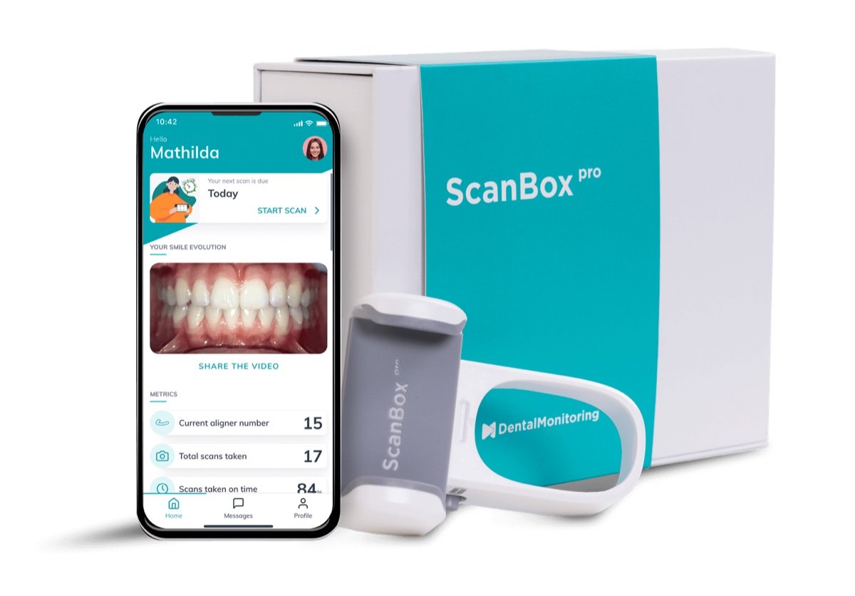 Dental Monitoring